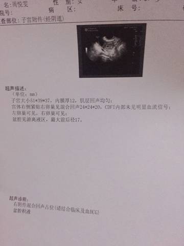 journal_insert_pic_576901710