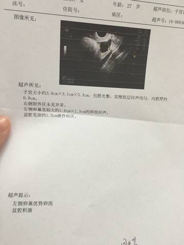 journal_insert_pic_577175870