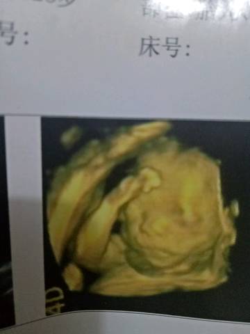 journal_insert_pic_577909071