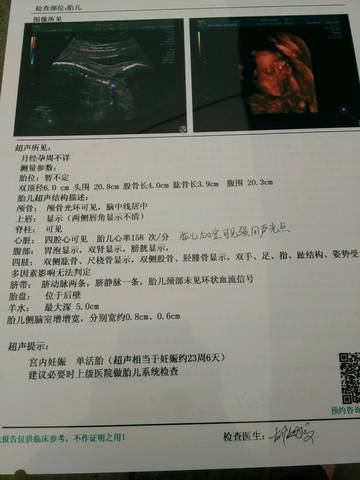 journal_insert_pic_578297095