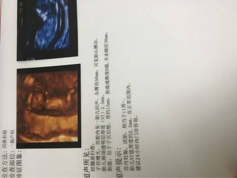 journal_insert_pic_578859496