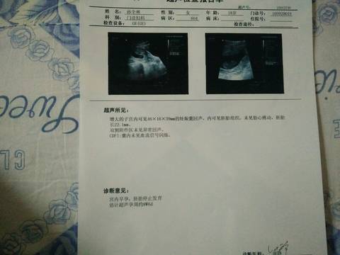 journal_insert_pic_579909719