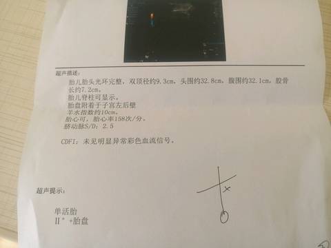journal_insert_pic_579904441