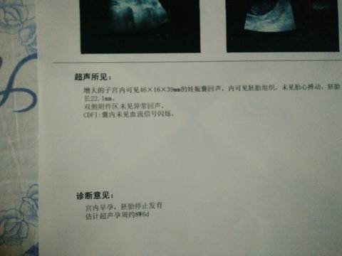journal_insert_pic_579909617