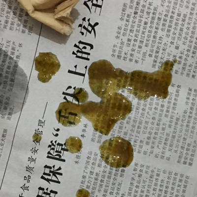 大便不成形颜色深褐色图片