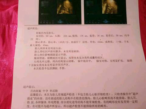 journal_insert_pic_581091094
