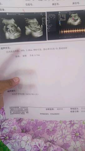 journal_insert_pic_583572349