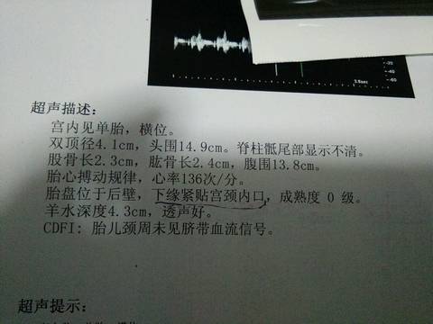 journal_insert_pic_583766825