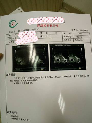 journal_insert_pic_585008436