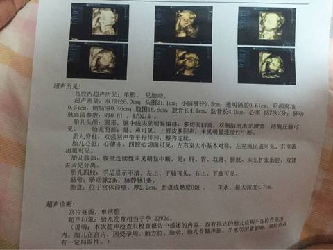 journal_insert_pic_586059791