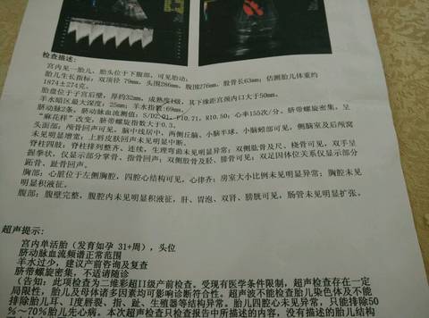 journal_insert_pic_586798388