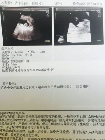 journal_insert_pic_588104769