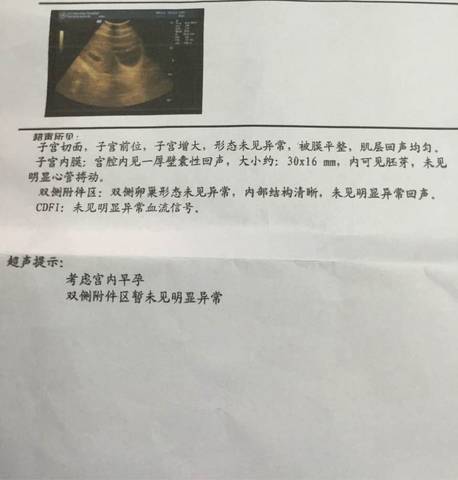 journal_insert_pic_588884043