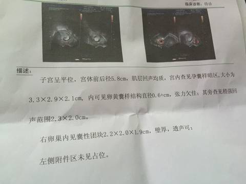 journal_insert_pic_590178102