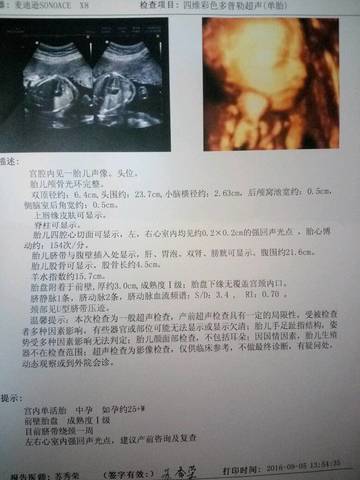 journal_insert_pic_591241346