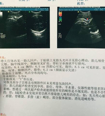 journal_insert_pic_590974424