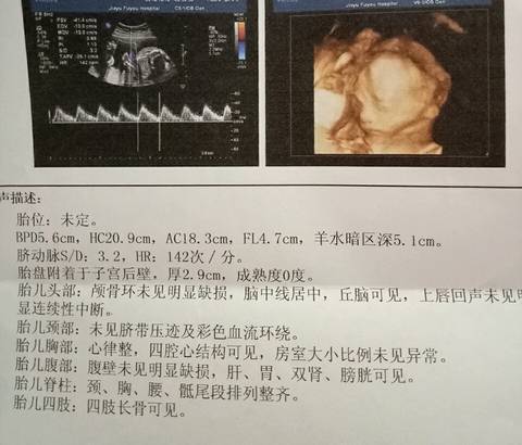 journal_insert_pic_592199243