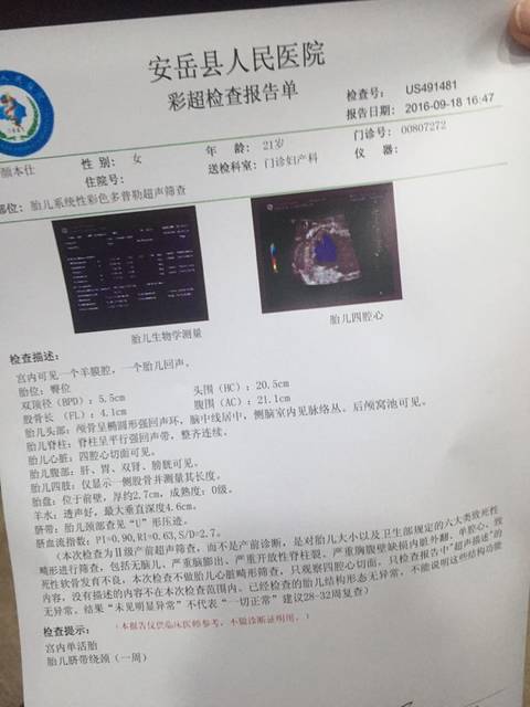 安岳四维彩超预约新体验