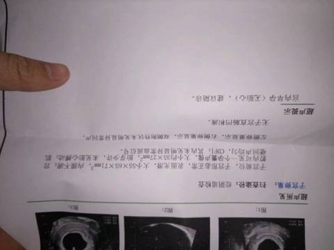 journal_insert_pic_597058324