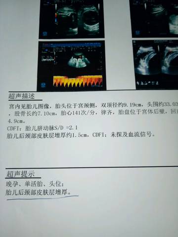 journal_insert_pic_596865250