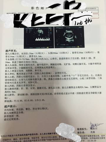 journal_insert_pic_597253947