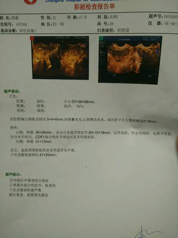 journal_insert_pic_597448103