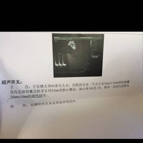 journal_insert_pic_598765334