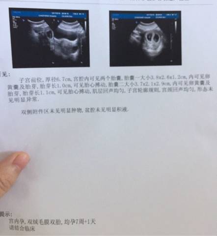 journal_insert_pic_598940908