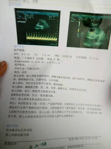 journal_insert_pic_599389709