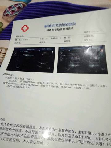 journal_insert_pic_601284781
