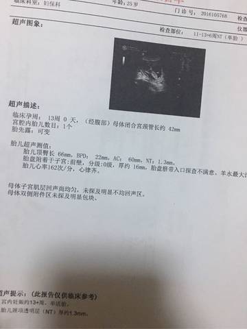 journal_insert_pic_601936407