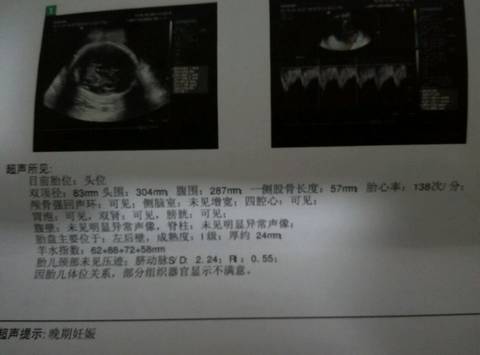 journal_insert_pic_602400550