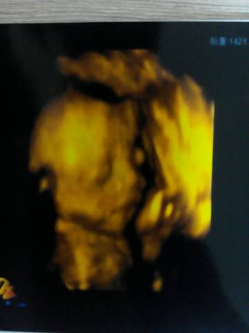 journal_insert_pic_604442131