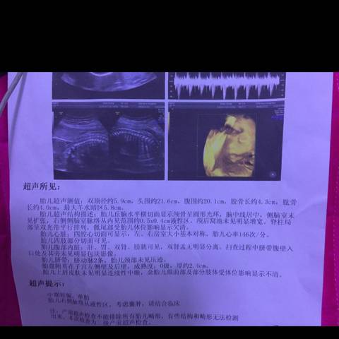 journal_insert_pic_606939129