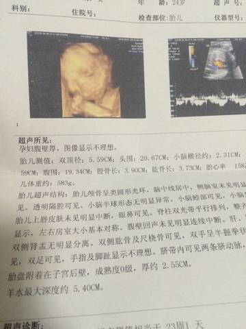 journal_insert_pic_607793832