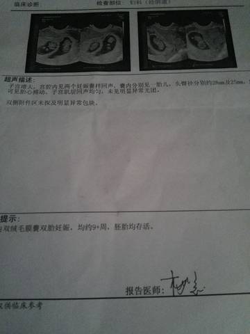 journal_insert_pic_609204339
