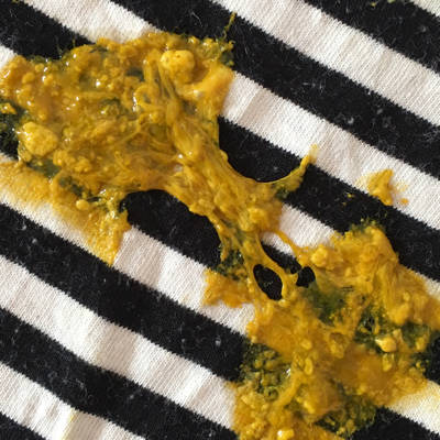 宝宝两个月了,从昨天开始拉的就比较频繁,昨晚好点,今天上午又拉了像