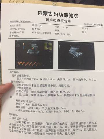 journal_insert_pic_609888950
