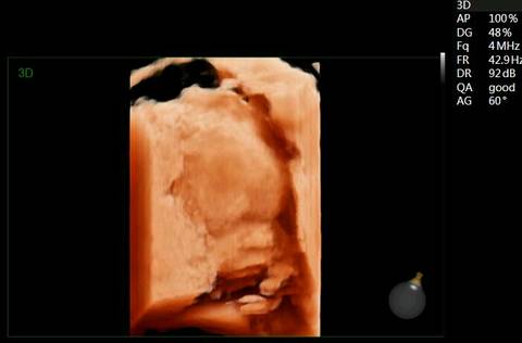 journal_insert_pic_612392009