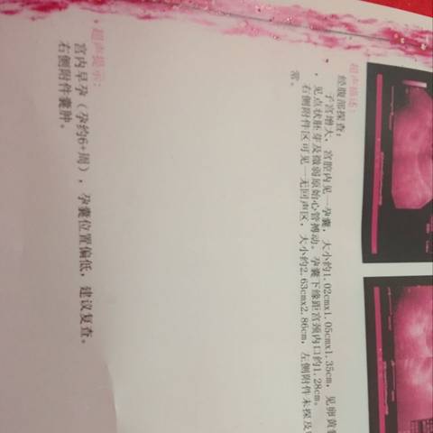 journal_insert_pic_613336085