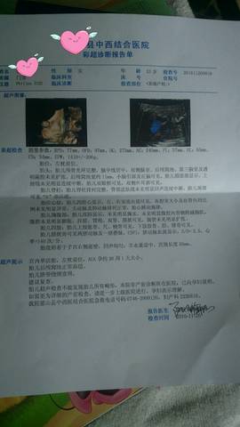 journal_insert_pic_615486010