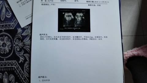 journal_insert_pic_616867164