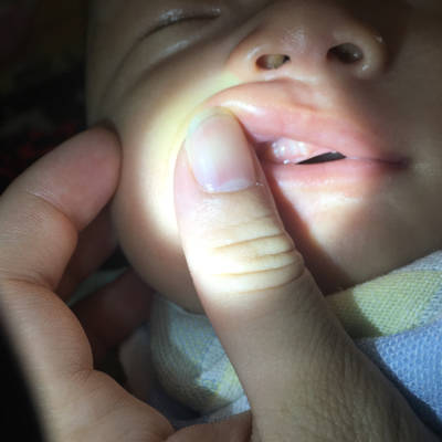 宝妈们,我宝宝50天了,无意中发现牙龈有这个白白的这是什麼东西啊