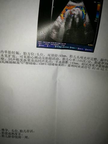 journal_insert_pic_623488675