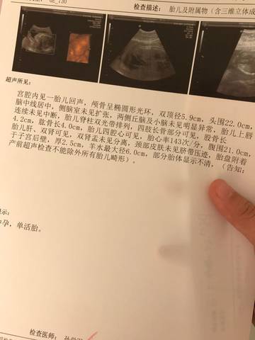 journal_insert_pic_626507900