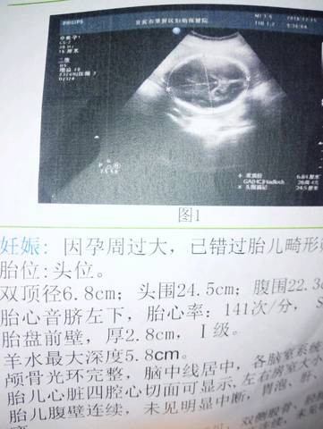 journal_insert_pic_627867892