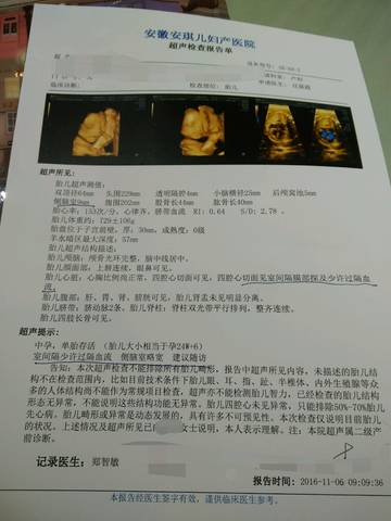 journal_insert_pic_629873209
