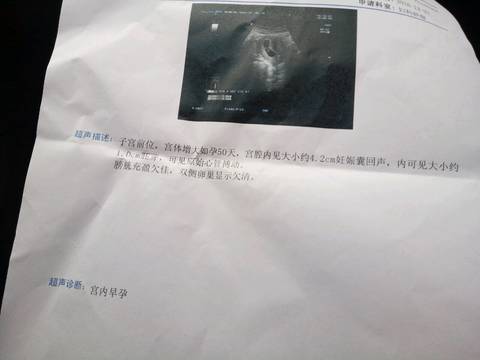 journal_insert_pic_630156503