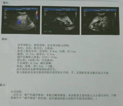 journal_insert_pic_630462255