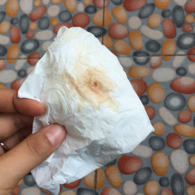 断断续续有血,已经十天了,中途检查一次,医生说没问